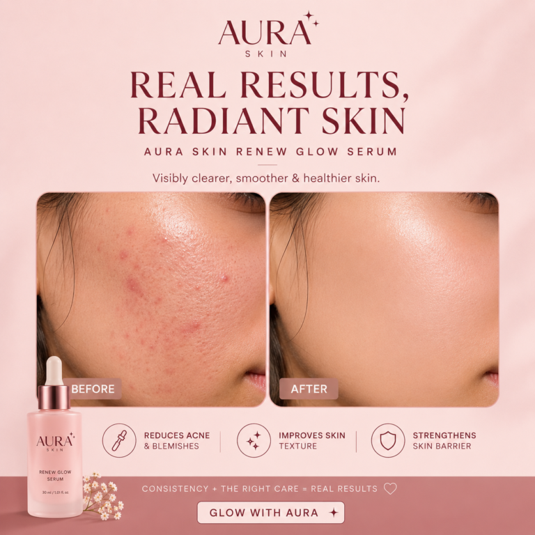 Luxury skincare Instagram post displaying a before-and-after close-up of a woman's cheek showing acne-prone skin compared with smoother, clearer skin after skincare. The design features Aura Skin Radiance Serum and highlights acne reduction, improved skin texture, and strengthened skin barrier in a blush pink aesthetic.